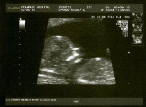 taylor george scan